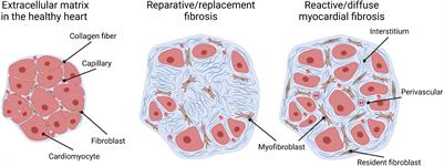Cardiac Fibrosis in the Pressure Overloaded Left and Right Ventricle as a Therapeutic Target